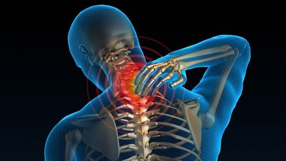 Durerea la întoarcerea gâtului poate indica sindromul vertebral al osteocondrozei cervicale