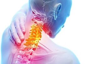 Cauzele osteochondrozei cervicale